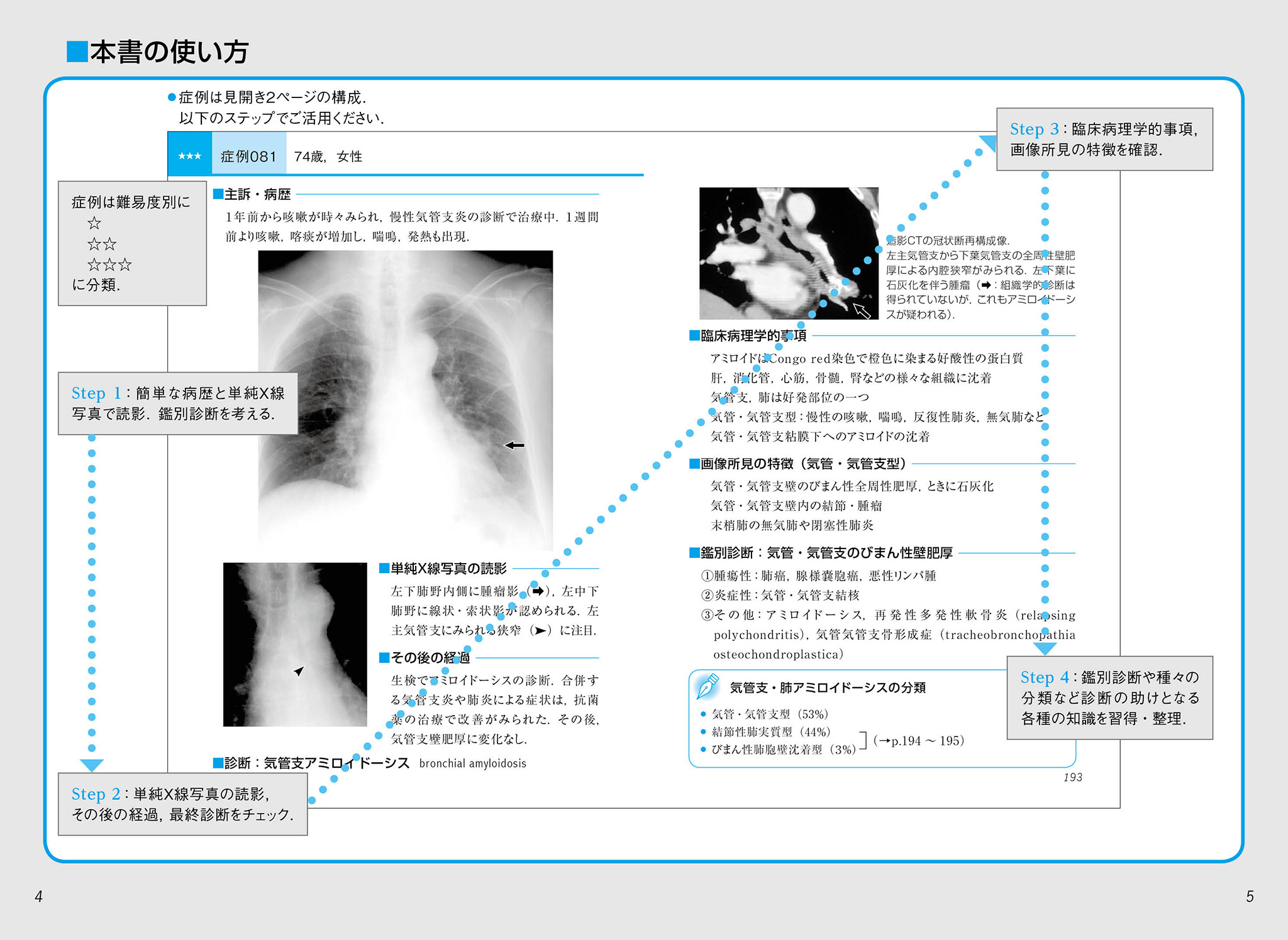 コンパクトX線シリーズBasic 胸部単純X線写真アトラス vol.1 肺 本書の使い方