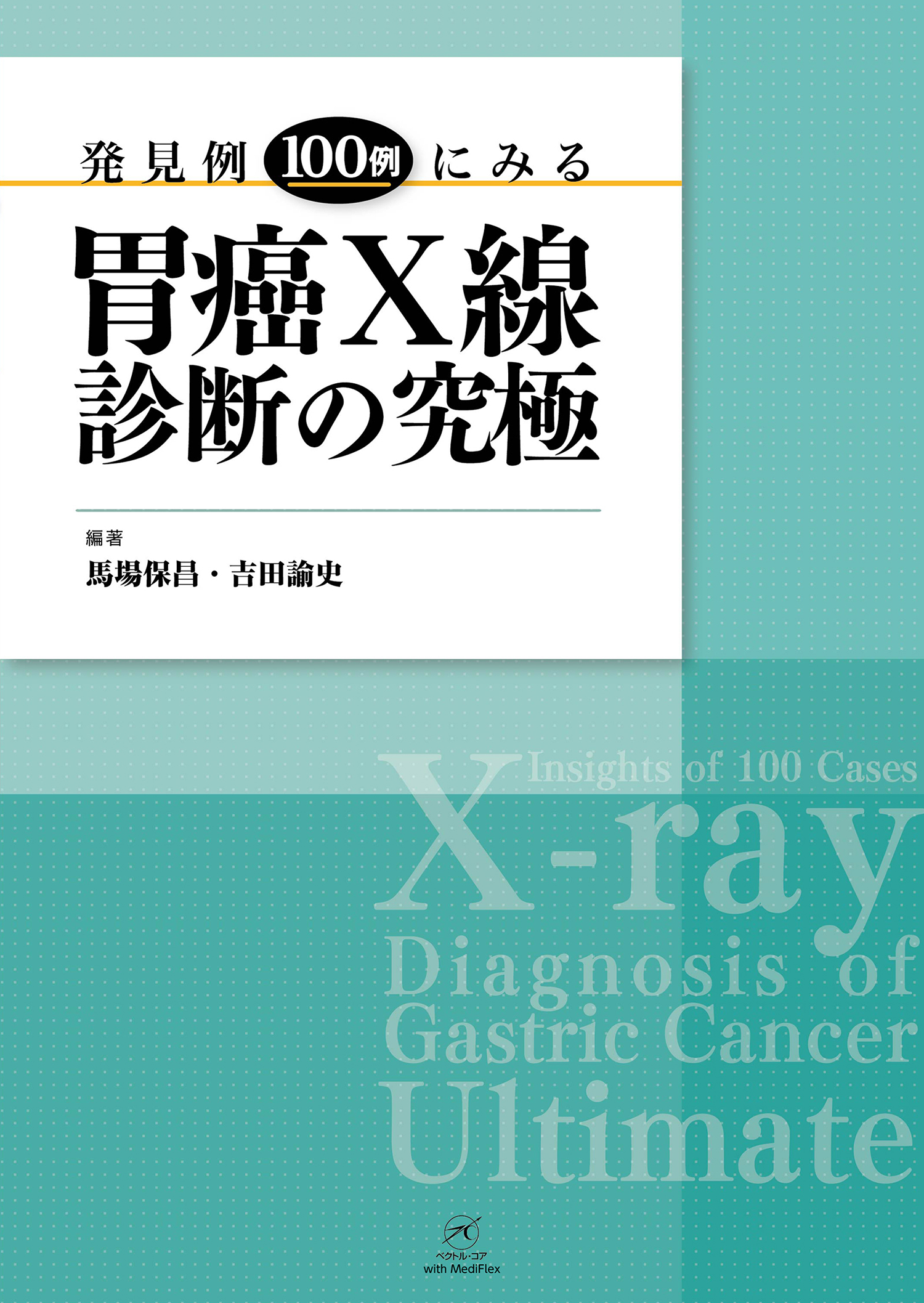胃癌X線診断の究極：発見例100例にみる